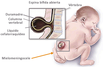 figura 1
